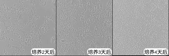 学术中心 贴壁培养细胞进入对数生长期,未达到汇合状态时即应