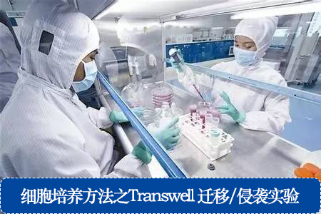 细胞培养方法之Transwell 迁移/侵袭实验