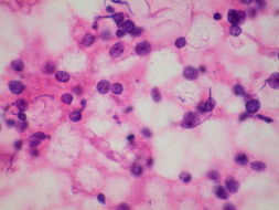 山东细胞实验:细胞的计数和铺板（以293细胞为例)